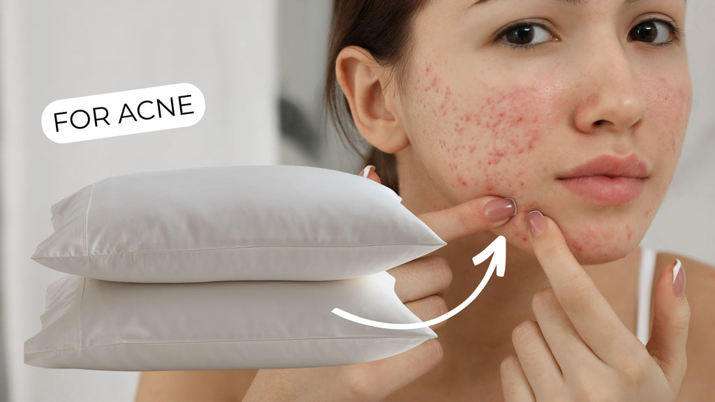 The best pillowcase for acne prone skin - Here is why.